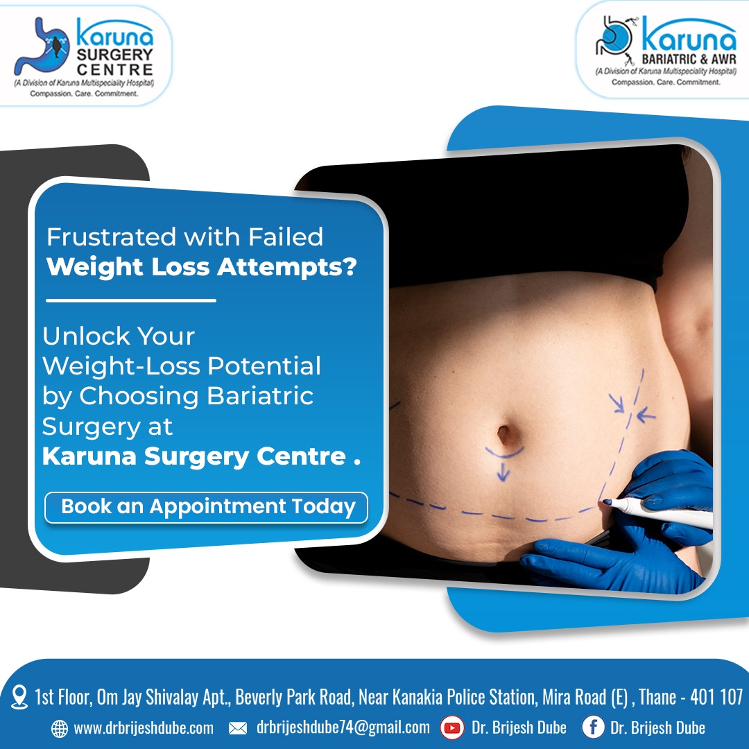 KarunaSurgery's tweet photo. Discover the transformative power of bariatric surgery at Karuna. Take the first step towards a healthier, happier you.

Contact us: 8080609821/7506008637

Visit us: https://t.co/FpdNrI2MFD

Share your review: https://t.co/cUrBhiJLLG

#karunasurgerycenter #WeightLossJourney https://t.co/YI3oXAq521