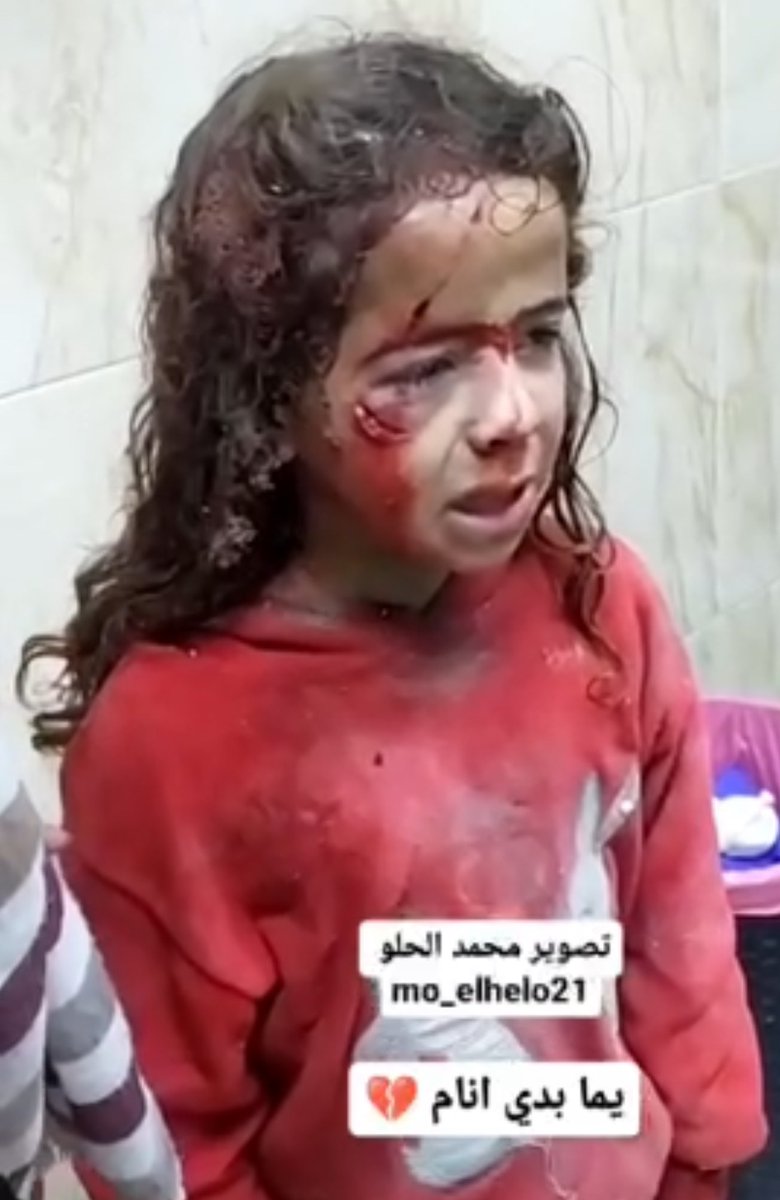 LOOK AT WHAT ISRAEL DID TO THIS YOUNG GIRL