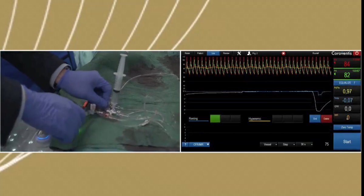 #CoronaryPhysiology
#MedEd

Hands-on needs  H A N D S !
Wish you were here…
