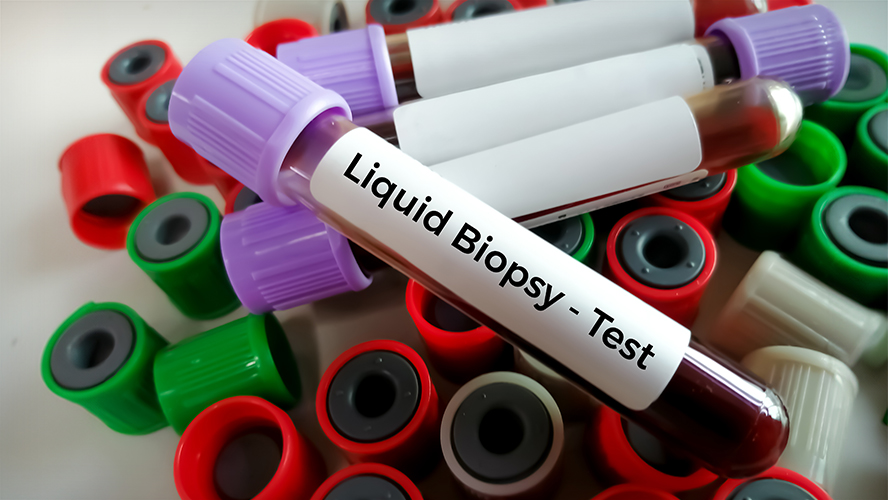 Can a blood sample be used to predict patient outcomes to #cancer #immunotherapy drug pembrolizumab? Researchers @Esanzgarcia, @zhaoEZ and @lillian_siu from @PMResearch_UHN investigate this in their new study. Read more > uhnresearch.ca/news/assessing…; doi.org/10.1158/2159-8…