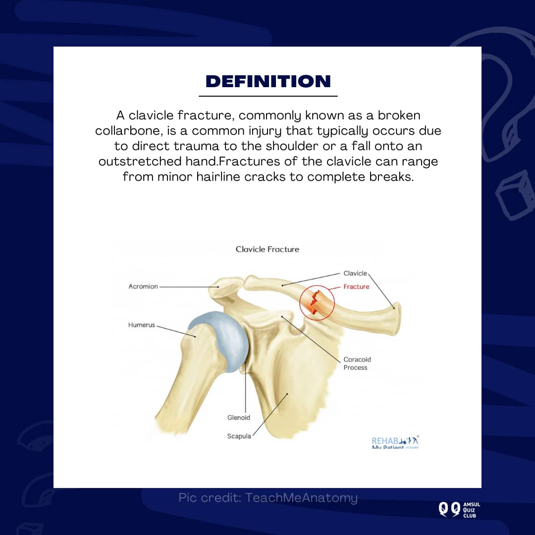amsulquizclub's tweet photo. Ready for our #stuffoftheweek? 🩺
Topic: Fracture of the Clavicle 🩻
Did you know that the clavicle is the most commonly fractured bone in the human body?
Dive into our post to learn more about clavicle fractures.
#BMS #anatomy
cont'd in next post>>> https://t.co/zZPjefPAs5