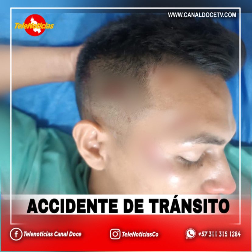 TeleNoticias Canal Doce tweet media