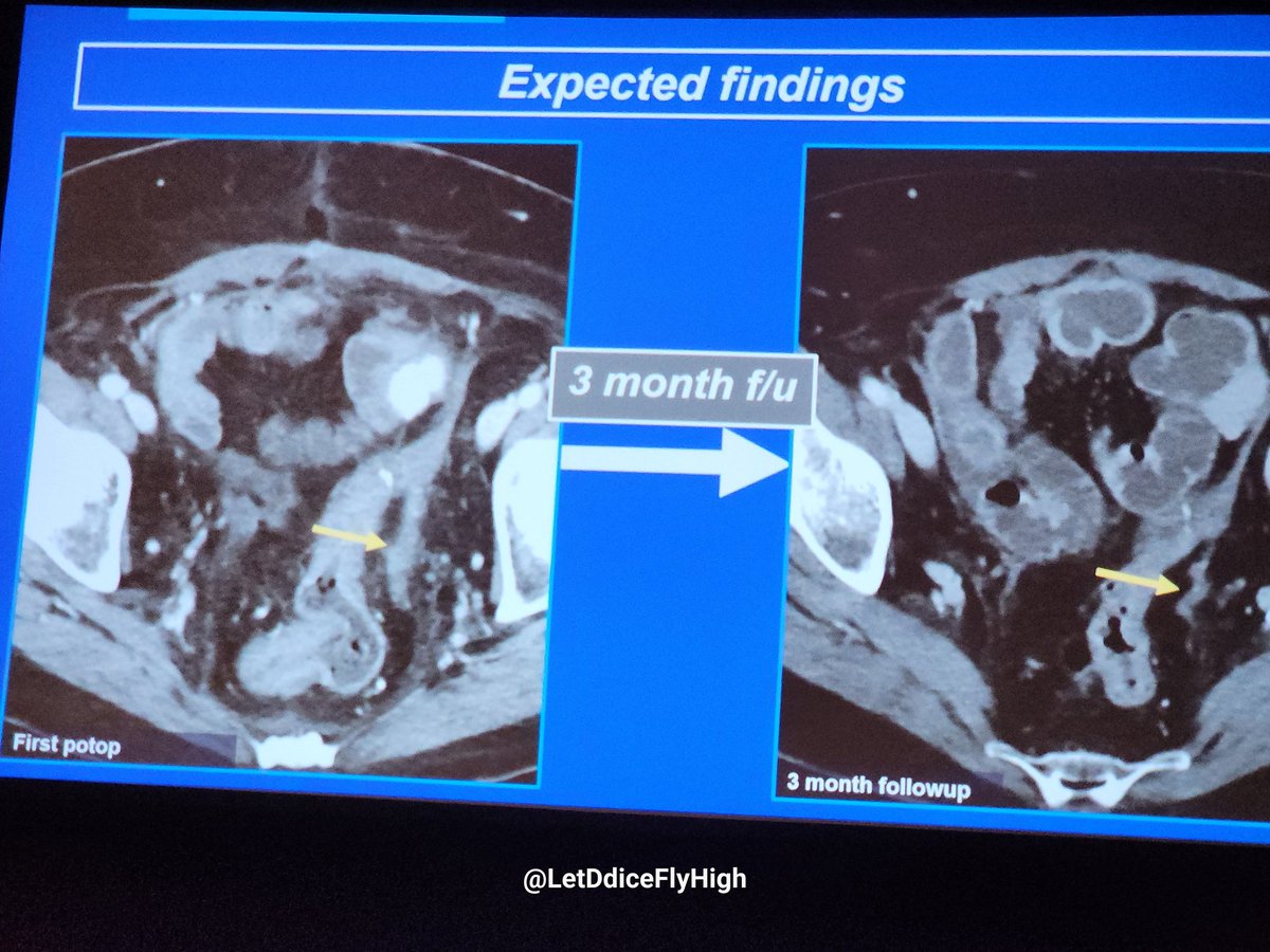 Its ok to hedge and say attention on follow up on first postoperative peritoneal surgery scan.

#SAR24