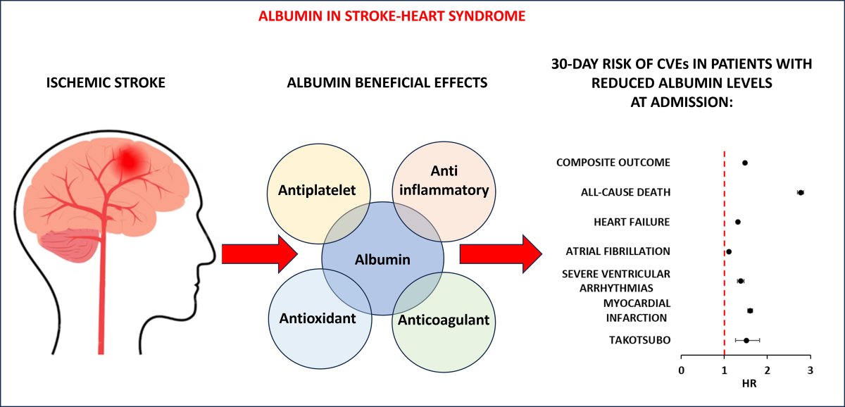 Do Low Serum Albumin Levels Increase the Risk of Cardiovascular Events in Ischemic Stroke? ahajournals.org/do/10.1161/blo… In our latest #BloggingStroke post, @B_Rioux discusses #Stroke article by @TommasoBucciMD et al. @georgentaios @AzmilAbdulRahim @LiverpoolCCS