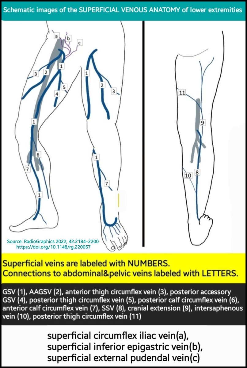 🟥Schematic images of SUPERFICIAL VENOUS anatomy of lower extremities. ✔️Innumerable subcutaneous tiny venules join to form minor veins that eventually drain into 2 main lower extremity superficial veins: great & small saphenous veins (GSV) & (SSV). doi.org/10.1148/rg.220…