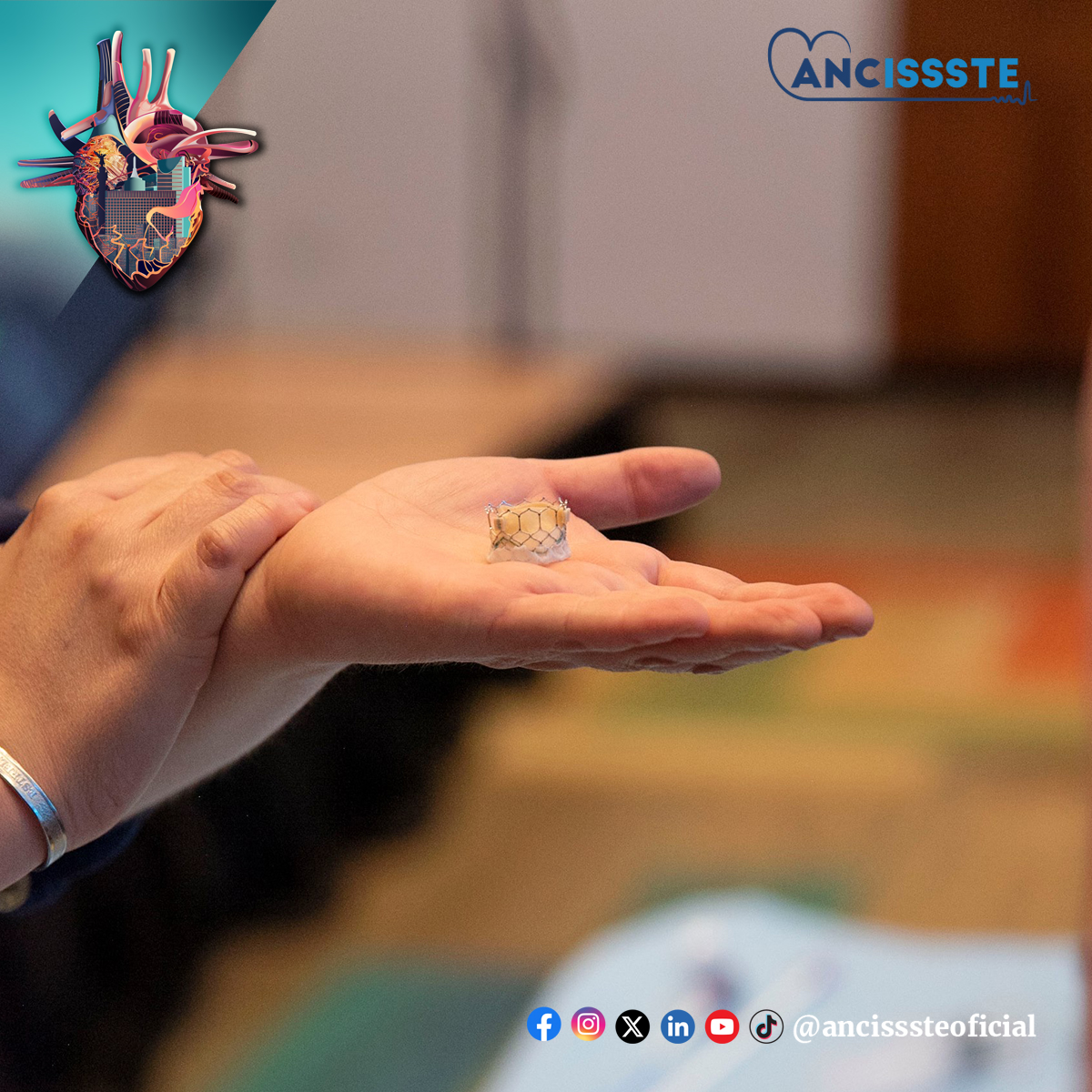 Grandes experiencias y prácticas durante el Taller de Intervencionismo Estructural en #enfermeria. #EnfermeríaANCISSSTE #EnfermeríaCardiológica #IntervencionismoEstructural #IntervenciónCardíaca #TecnologíaCardíaca #TratamientoCardíaco #InnovaciónCardíaca #SaludCardiovascular