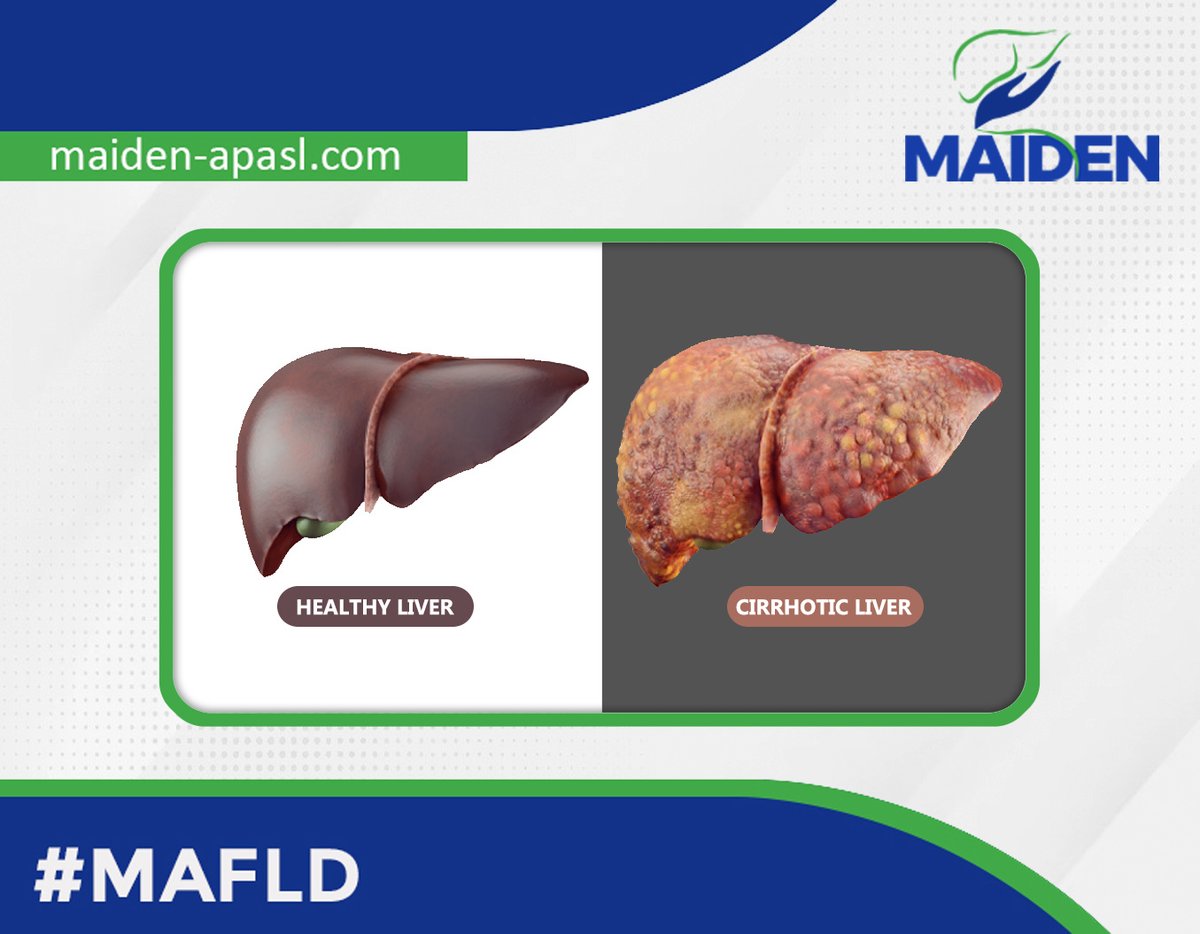 Please do not forget everything that makes your liver looks like this that you have the power to change:
1. Alcohol
2. Hepatitis C virus 
3. Hepatitis B virus
4. Metabolic dysfunction associated fatty liver disease.
👉maiden-apasl.com/patients-resou…
 #livertwitter #medtwitter #MAFLD