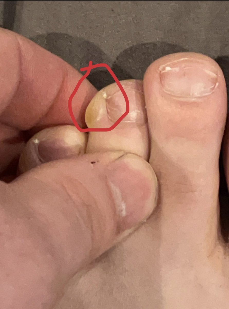 chargrove15's tweet image. Brought this little guy back with me from Montreal! DM if you want the spicy link to more feet pics 🔥😂 #runningproblems #whatshouldinamehim