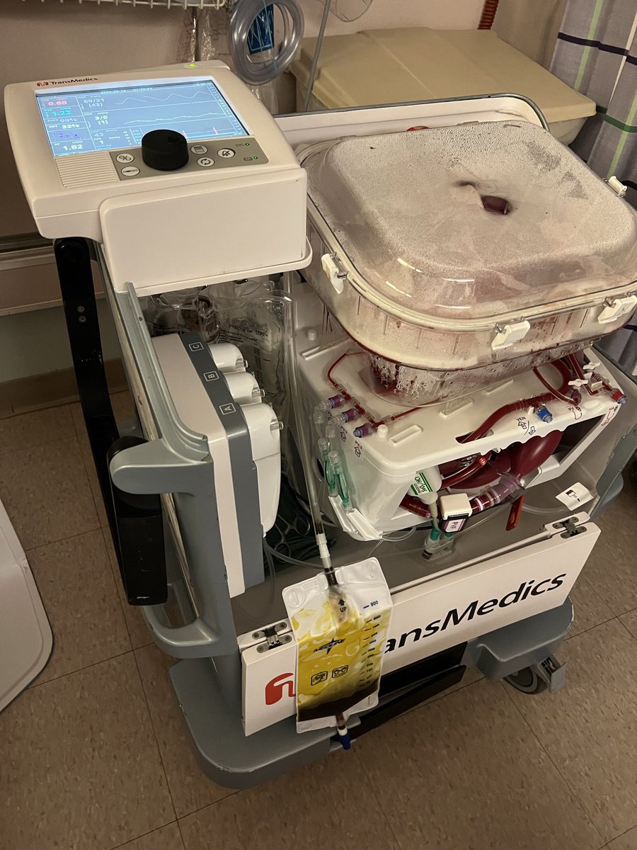 LeeDavely's tweet photo. In Feb 2023, @BIDMCTransplant began a partnership with @transmedics, to provide normothermic machine perfusion for liver allograft preservation.  Yesterday we did our 100th case.  No better demonstration of @BIDMC’s commitment to do the best for their patients no matter the cost. https://t.co/CoXOmxhfrc