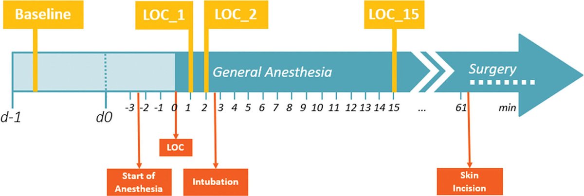 Findings suggest that electroencephalogram markers obtained during loss of consciousness at #anesthesia induction may serve as electroencephalogram-based biomarkers to identify early on patients at risk of developing postoperative delirium. Learn more: ow.ly/9YNc50RgCIu