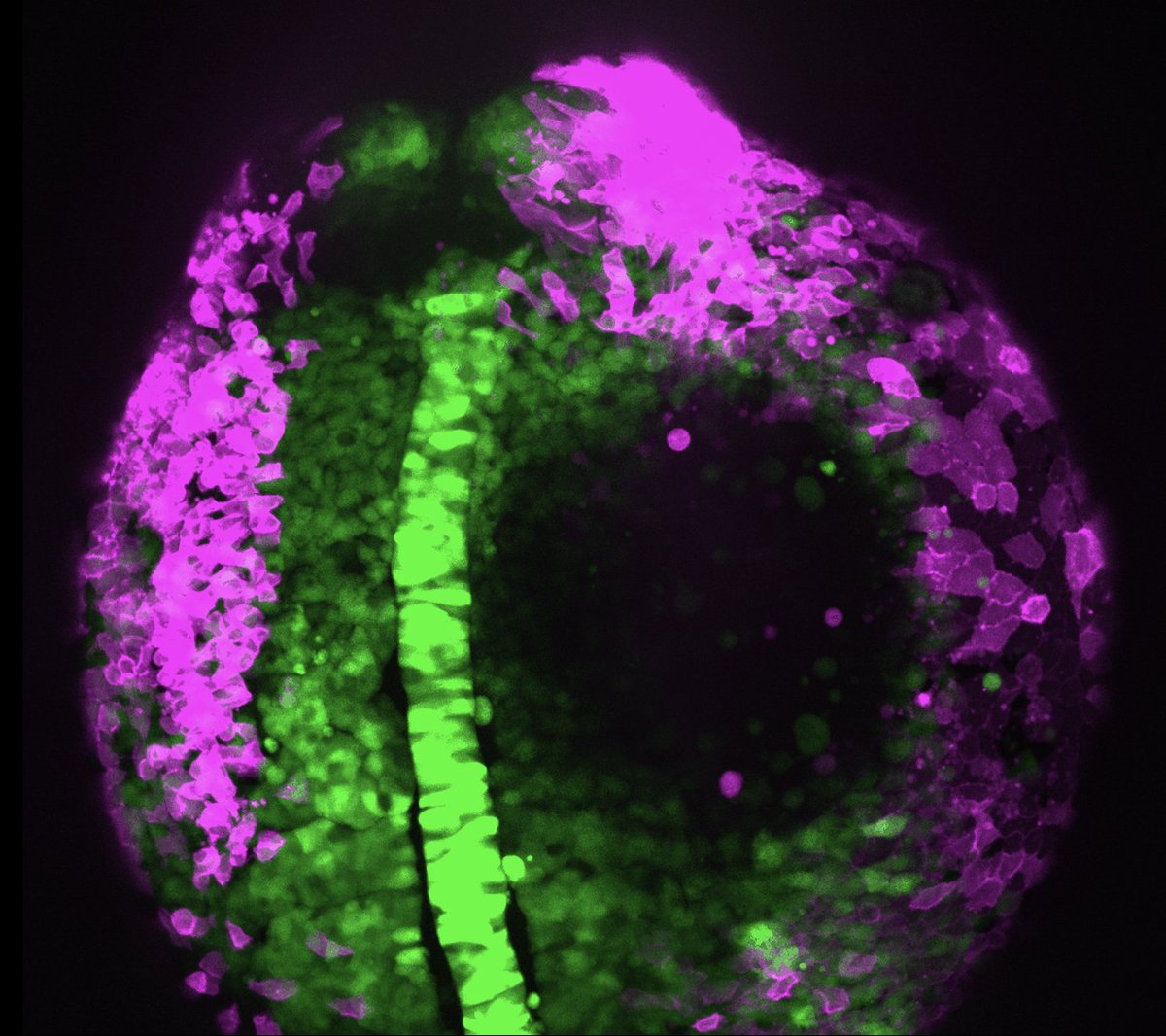 ZebrafishRock's tweet photo. Our #SpotlightZebrafish this week is on Alyssa Emig (@AlyssaEmig), a PhD student with @GetYourChorion @bcmhouston. Her research is focused on understanding the importance of Nodal and BMP signaling in neuroectoderm morphogenesis during gastrulation. (1/2) https://t.co/Z0xWMmiGBv