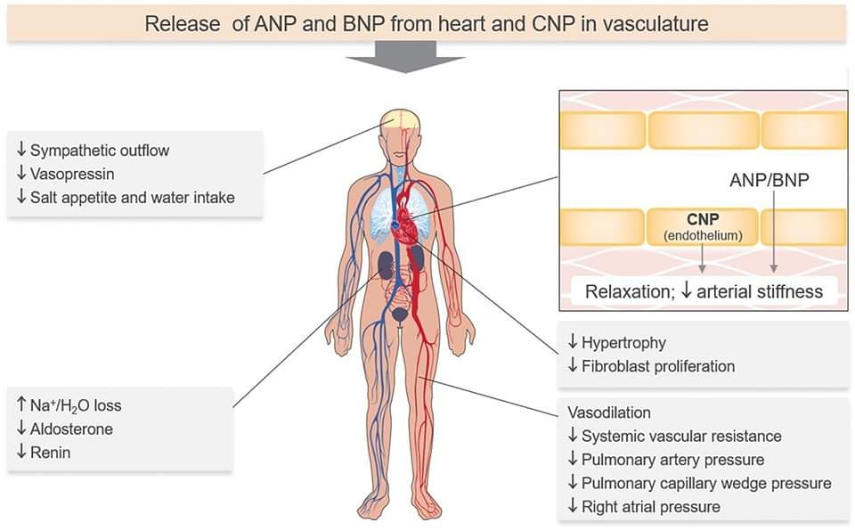 🔴 Natriuretic Peptides: Role in the Diagnosis and Management of Heart Failure: A Scientific Statement From the HFA of the ESC, HFSA & JHFS #openaccess #2023Review

onlinejcf.com/article/S1071-…
#CardioTwitter #CardioEd  #CardioTwitter