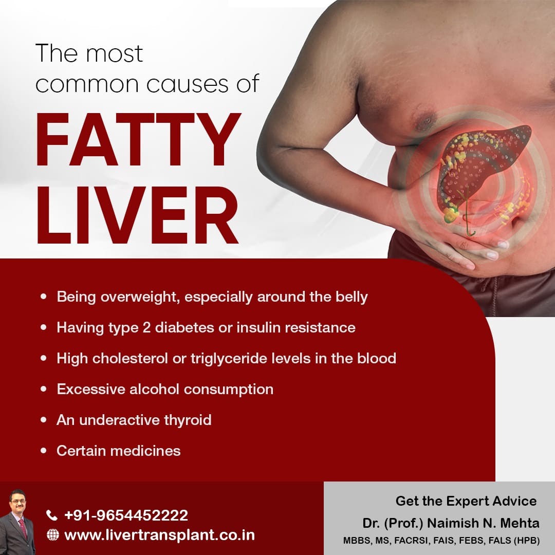 The most common causes of Fatty liver are:
- Being overweight, especially around the belly
- Excessive alcohol consumption
- an underactive thyroid
- certain medicines

#fattyliver #fattyliverdisease #fattylivertreatment #liver #liverProblems #DrNaimishMehta