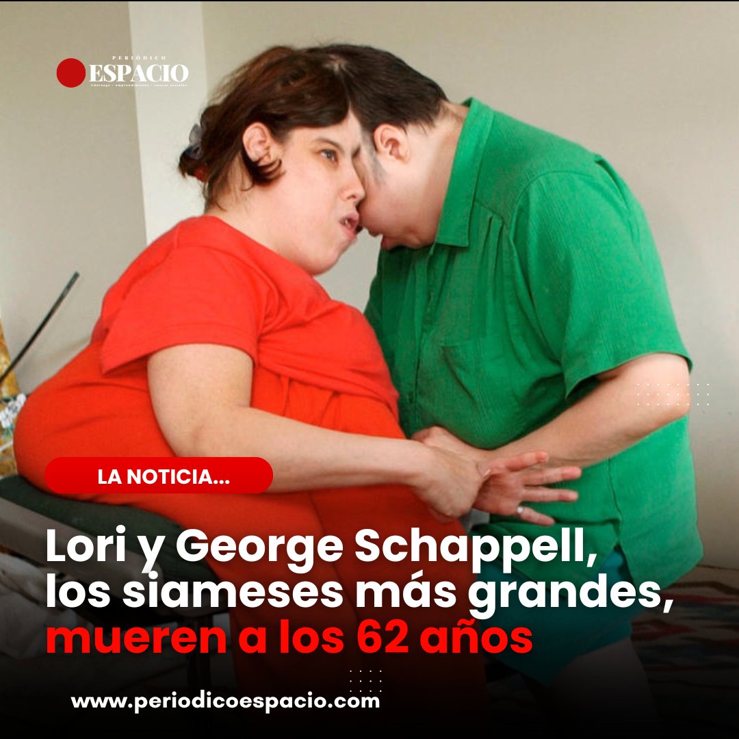 👭 ¡Una vida juntos y separados! Los siameses Lori y George Schappell dejaron un legado que desafió las expectativas médicas hasta el último aliento. 💔 periodicoespacio.com/lori-y-george-…