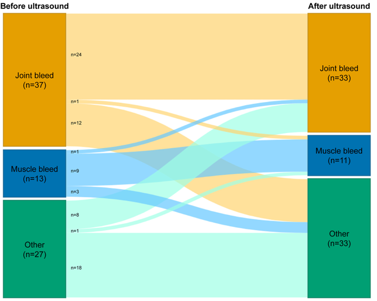 🔍 van Leeuwen and team report that point-of-care ultrasound significantly impacts the diagnosis and treatment of acute musculoskeletal episodes in #hemophilia and #VWD patients. Ultrasound changed the diagnosis in 36% and treatment in 39% of cases! rpthjournal.org/article/S2475-…