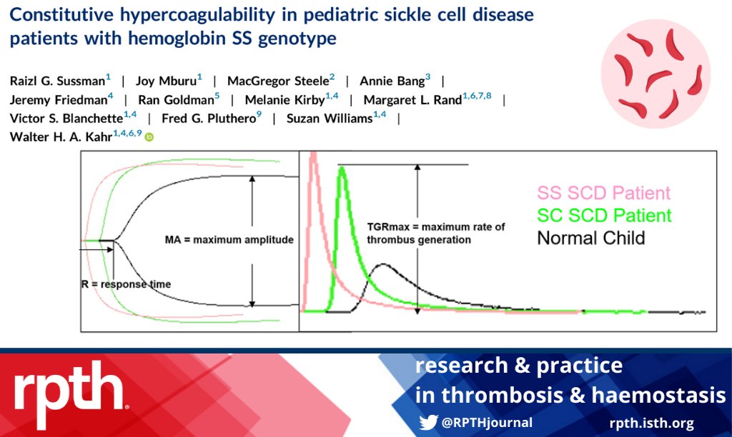 🩸 New study using thromboelastography reveals that pediatric #sicklecelldisease patients with HbSS genotype exhibit constitutive hypercoagulability, highlighting potential differences in hemostatic activity between HbSS and HbSC patients. ❤️rpthjournal.org/article/S2475-…