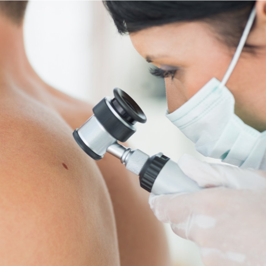 Did you know that regular skin checks can be lifesaving? Early detection of skin cancer increases the effectiveness of treatment and can save lives. Don't put it off - schedule your skin check today! 🌞

#SkinHealth #Dermatology #EarlyDetection #SkinCancerAwareness