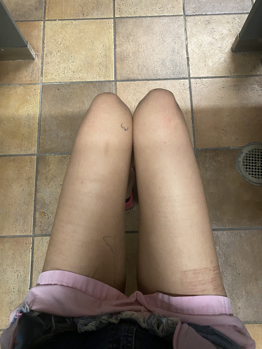 Everybody is noticing my weight loss I feel so happy