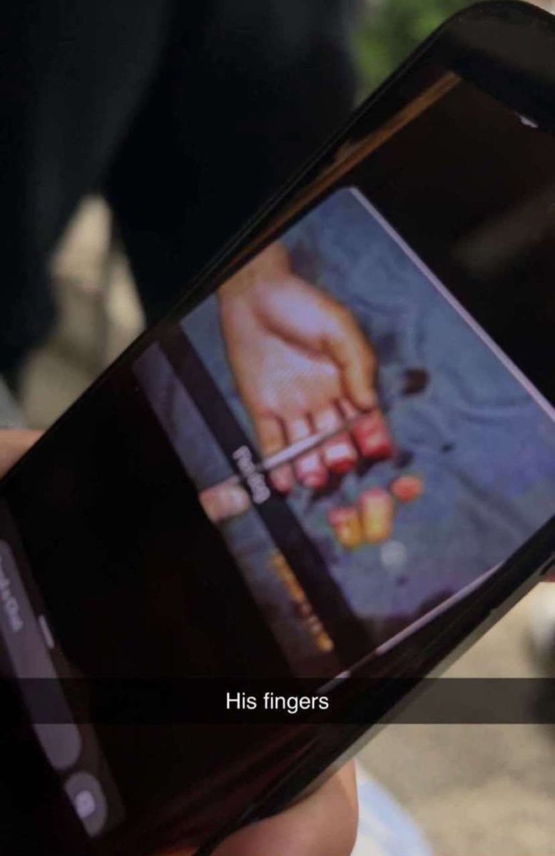 shivanshu1239's tweet photo. Image shows the Sydney Bishop stabber with an injured hand
Rumours have been circulating about his fingers being chopped off by furious churchgoers
#Sydney #SydneyAttack #Attack #GoodShepherdChurch #Church #Christ #JUSTIN #AssyrianAramaicChurch #Bishop #MarMariEmmanuel #stabbing https://t.co/MFJSXSrd9P