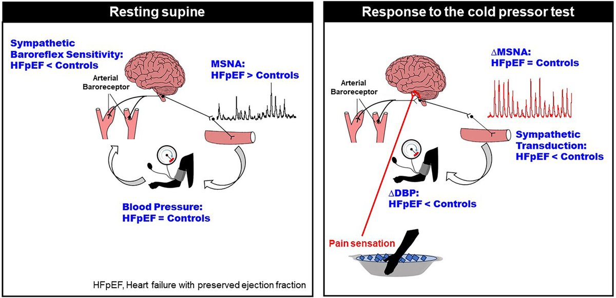 Sympathetic Neural Control at Rest and During the Cold Pressor Test in Patients with Heart Failure with Preserved Ejection Fraction ahajournals.org/doi/10.1161/HY…