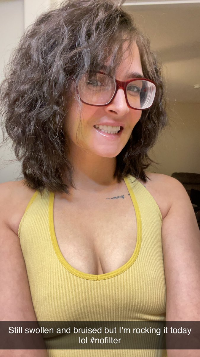 ItsZoeyKush's tweet photo. On my healing journey and not hiding it today lol 🤪 would yall still come see me on OF in my healing phase lol? https://t.co/o1Paf3B3FT