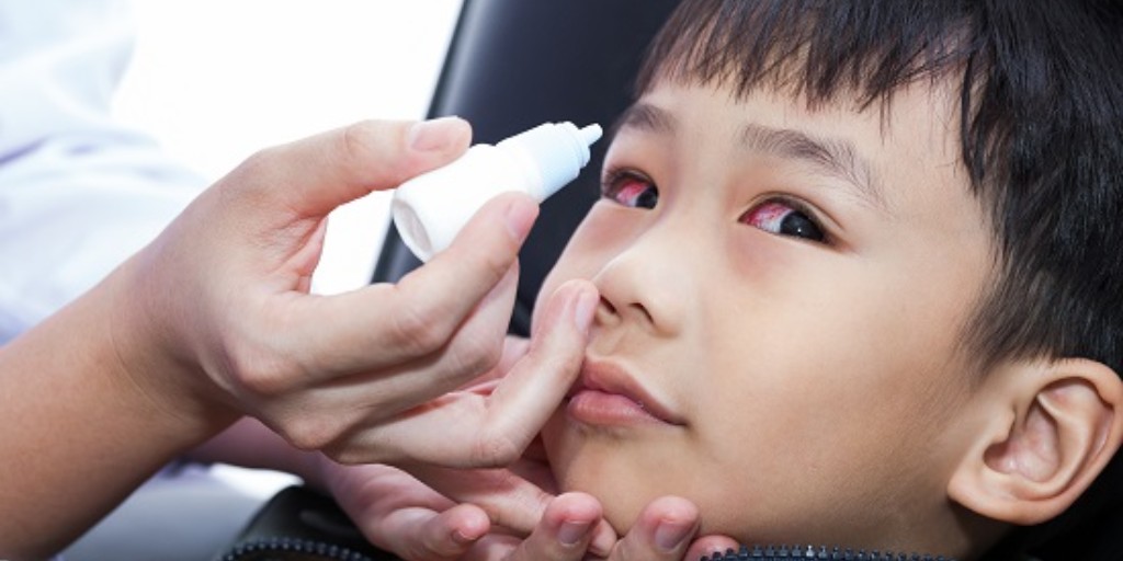 If your child has pink eye, they may have redness in their eyes and eyelids, slightly swollen eyelids, itchy eyes and clear or yellow-green eye discharge. Learn more about the signs and symptoms of pink eye and how to treat your child's pink eye: ow.ly/Iqch50Rcryt