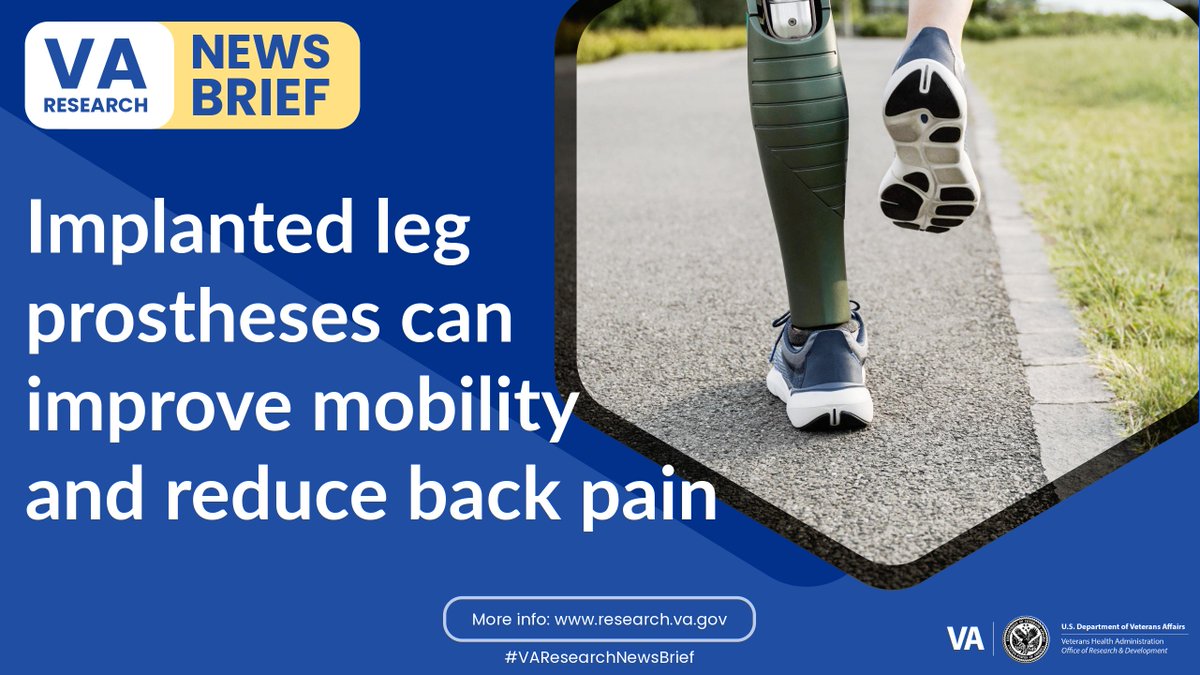 #VAResearchNewsBrief: @VAECHCS researchers and their colleagues showed a leg prosthesis implanted directly to the bone can improve walking and reduce lower back pain in people with amputations. #VAResearch research.va.gov/in_brief.cfm#2…