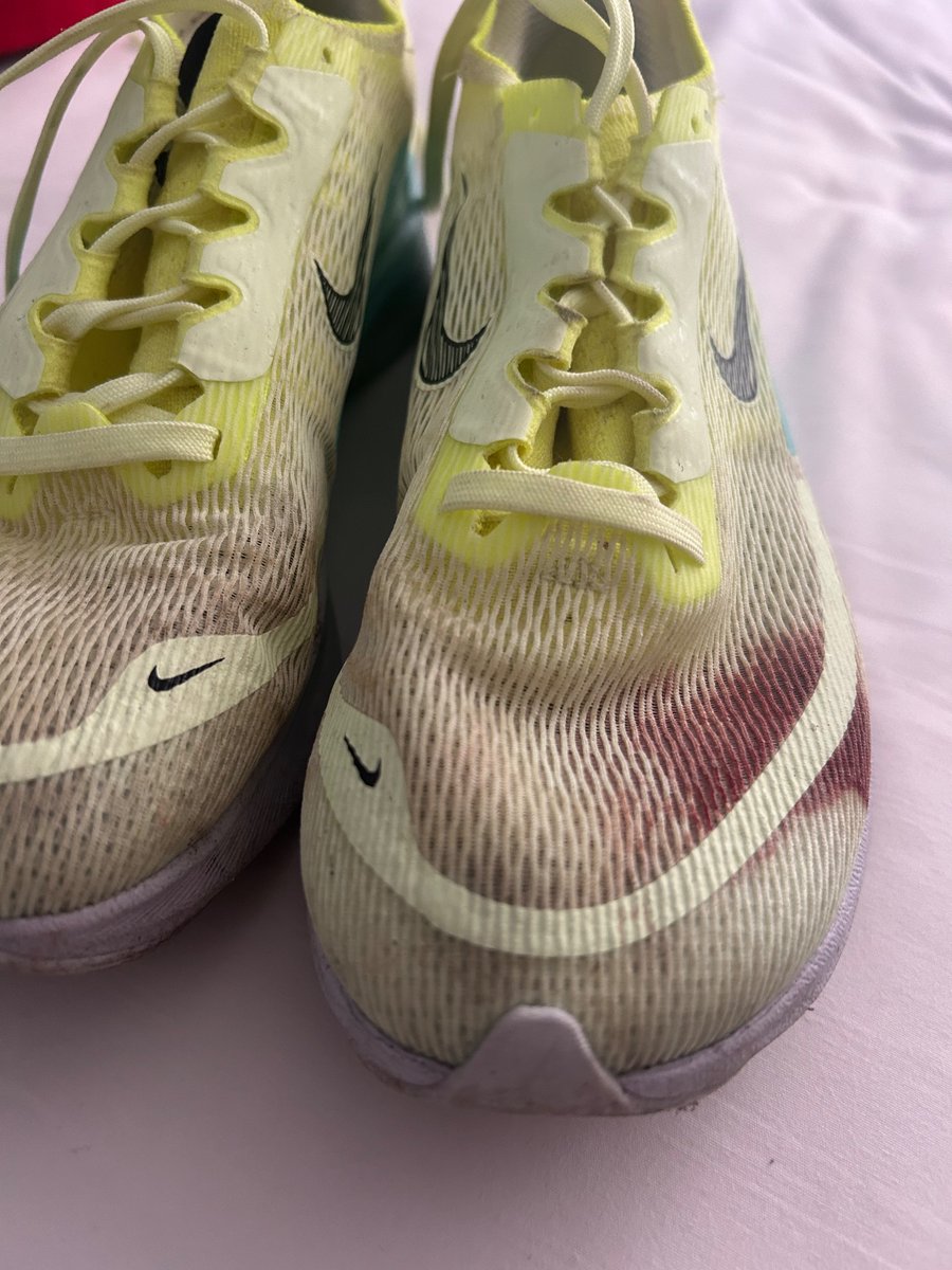 My daughter is pretty darn tough. She just finished the Boston Marathon. These are her shoes. That is her blood. #Finisher @bostonmarathon #finishstrong #powerthrough #prouddad