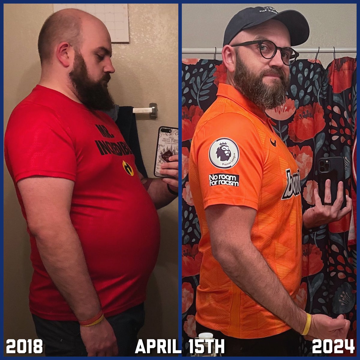 MarcVibbert's tweet photo. Six Years Progress 💪🏼
⠀
#AndyDwyerDiet #WeightLossTransformation #WeightLossJourney #WeightLoss #muscletoning #sixyears https://t.co/B2gUZCJnPC