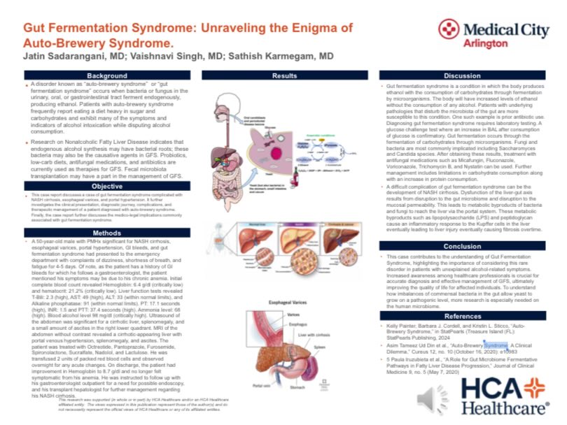 Gut fermentation syndrome (auto-brewery syndrome) complicated by #cirrhosis. #MedTwitter #GITwitter #microbiome scholarlycommons.hcahealthcare.com/northtexas2024…