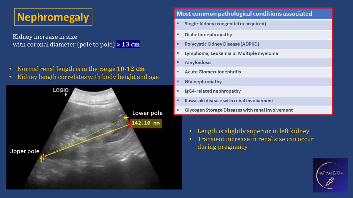 #POCUS #Renal #Nephpearls What are we talking about when we say NEPHROMEGALY ... A small panel for trainees and students