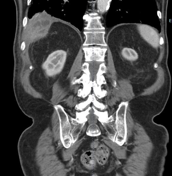 Ron Barbosa MD FACS tweet media