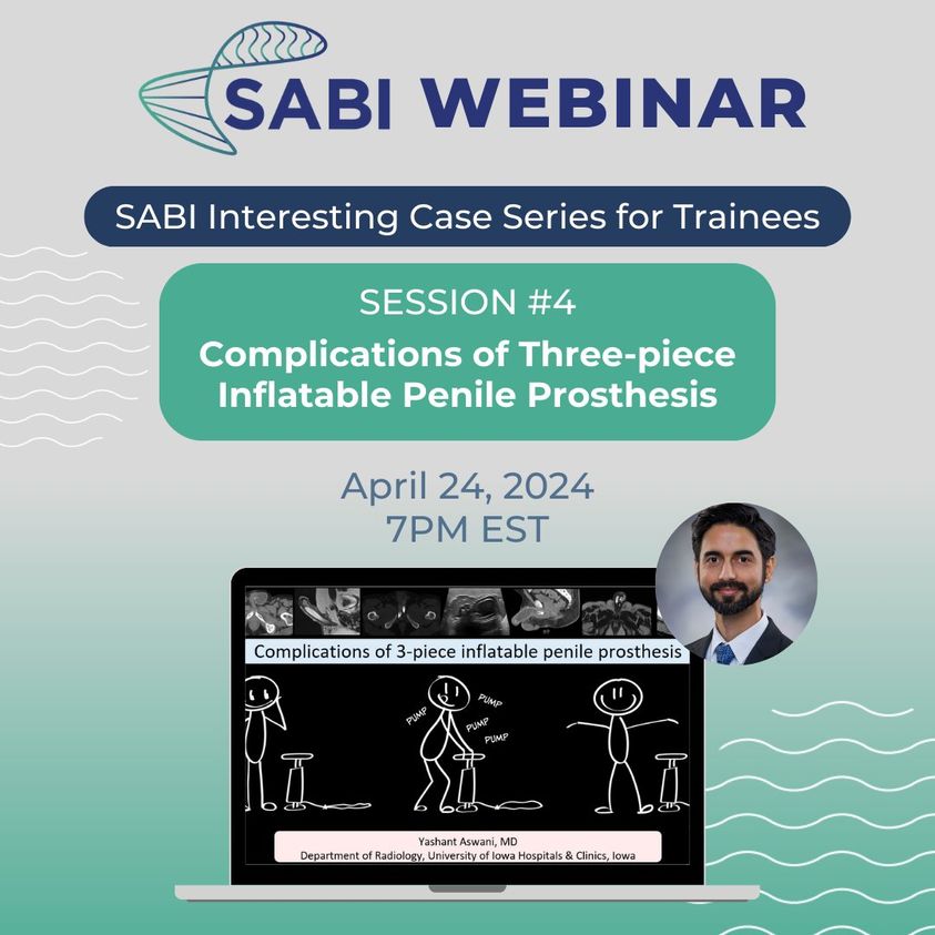 Join Dr. Yashant Aswani for our next Interesting Case Series webinar on Wednesday, April 24th! This free session will delve into the complexities of three-piece inflatable penile prostheses (IPPs), a common treatment for erectile dysfunction (ED) bit.ly/49vp1Kf