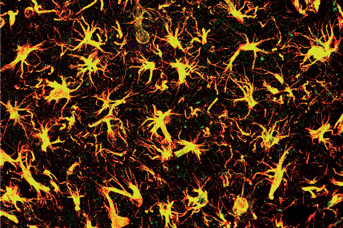 This explosive image is not of stars, but of spinal cord cells! Learn more about this #ScienceArt and see even more amazing pieces at our gallery! Image by Dr. Issa Yusuf in the Xu Lab. umassmed.edu/bmb/outreach/s…