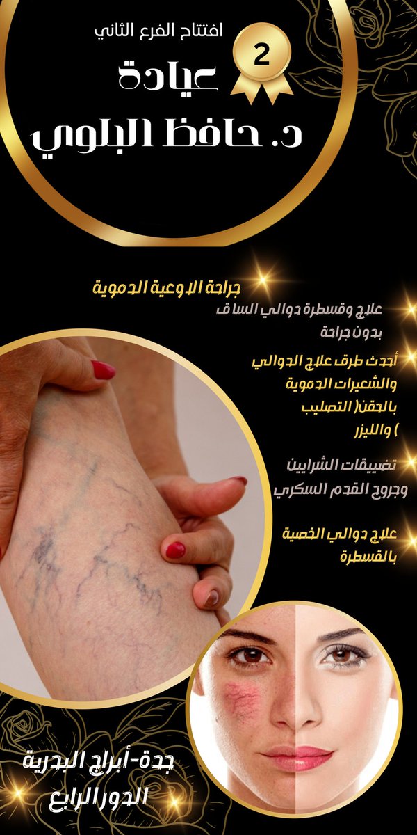DrAlbalwi's tweet photo. @Dr_mahaalnemer علاج #دوالي_الخصية بالقسطرة عن طريق اليد #جده_lلان https://t.co/uVU9CJE4aL