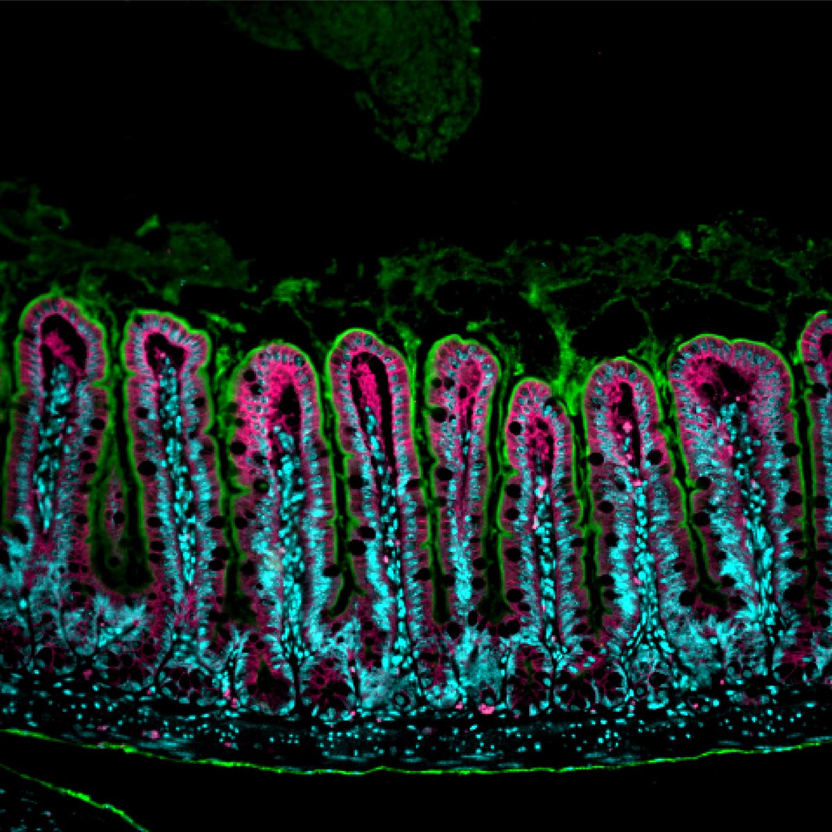 Happy #MicroscopyMonday!
Looking for areas of intact intestinal villi in my samples feels like a scavenger hunt 🔎
#sciart #microscopy #bioart #GITwitter