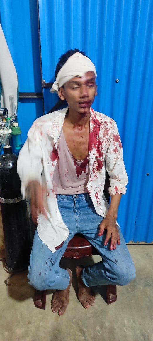 TawkiRo's tweet photo. Monjur Alam, a #Rohingya teacher, was heavily tortured last night by members of an armed group in camp-1. He is now in critical condition. Previously, his father was fatally attacked in camp-4. Despite relocating to camp-1 for his safety, he continues to face dire circumstances. https://t.co/uGP4WmNfwf