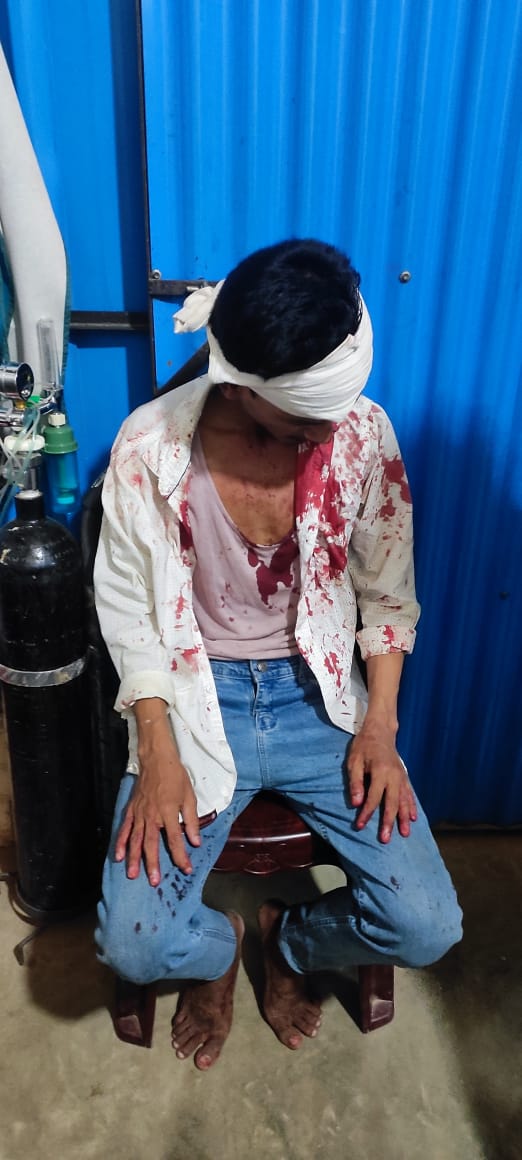 TawkiRo's tweet photo. Monjur Alam, a #Rohingya teacher, was heavily tortured last night by members of an armed group in camp-1. He is now in critical condition. Previously, his father was fatally attacked in camp-4. Despite relocating to camp-1 for his safety, he continues to face dire circumstances. https://t.co/uGP4WmNfwf