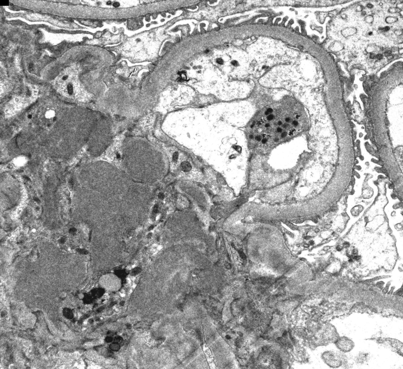 JZRenalPath tweet picture