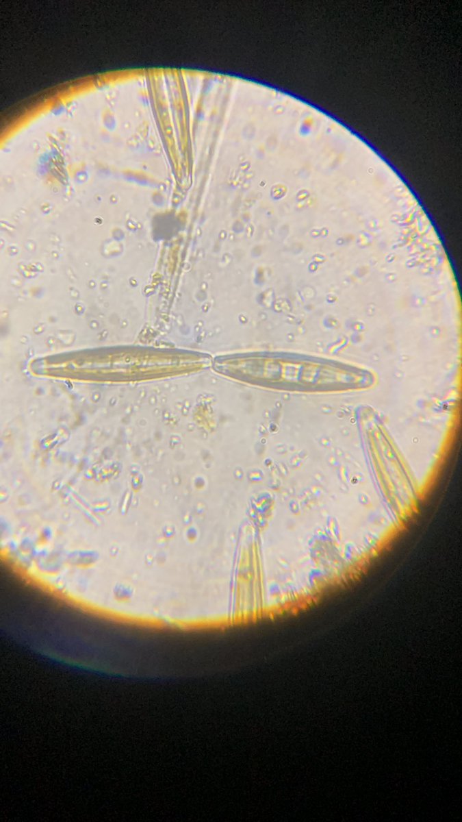 I took a sample of my creek water to see how healthy it is, but instead I intruded on an intimate moment between 2 diatoms… 😳😳