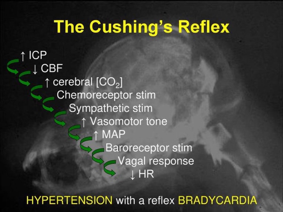 What do you know about Cushing  reflex ?