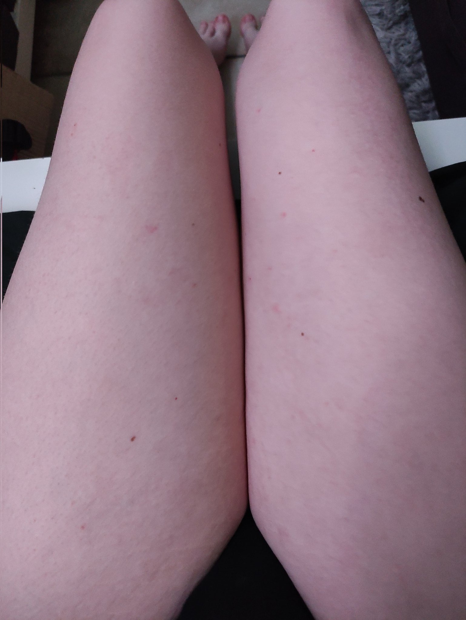 Who wanna get squeezed by a chubby trans girl? :3 https://t.co/RaZvRevPja