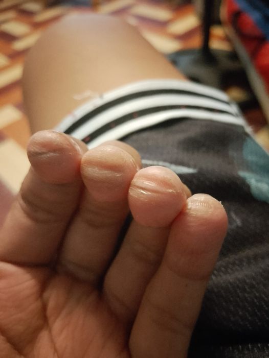 Only guitar players can relate :(((

Practice & learn guitar with IGuitar : apps.apple.com/us/app/guitar-…

#guitar #guitartuner #music #guitarlearing #guitarchords #guitartutorial #guitarplayers #guitardaily #learnguitar #musictheory #iguitar #GuitarStrings #MusicTips #basstutorial
