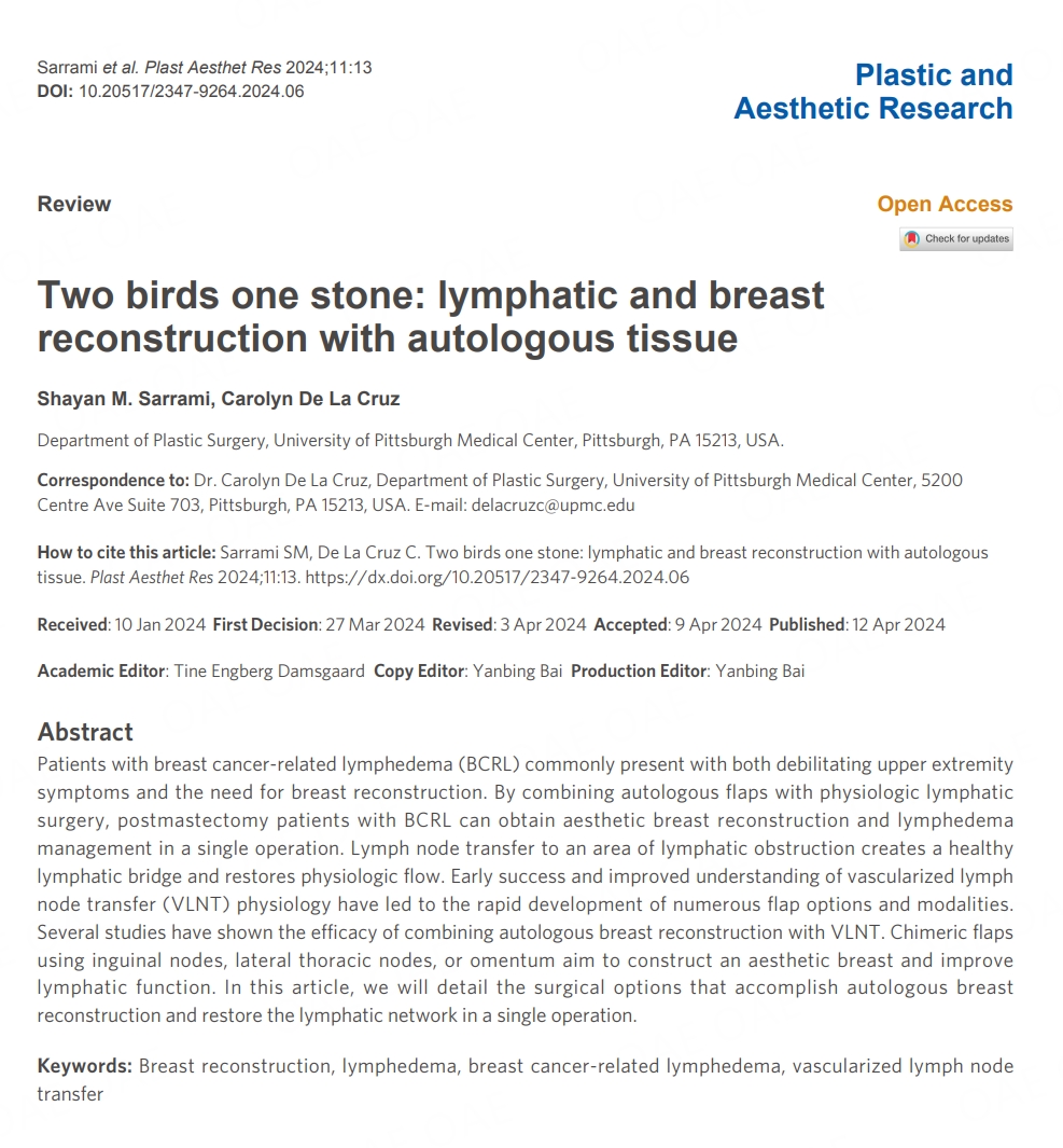#Breast #Reconstruction #Lymphedema 🌟 Fresh off the press! Our latest publication is here: 'Two birds one stone: lymphatic and breast reconstruction with autologous tissue'. Discover the groundbreaking research on dual-purpose reconstruction using... 🔍 oaepublish.com/articles/2347-…