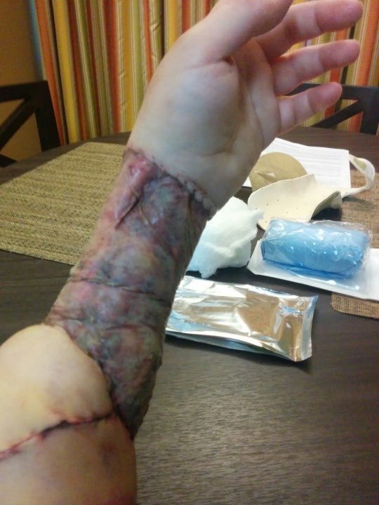 When they say “gender affirming care” this is what they mean. The sterilization, m*tilation, and castration of minors.

The Supreme Court ruled today that Idaho can enforce a ban on these procedures and treatments.

This is the biggest medical scandal in modern history and it