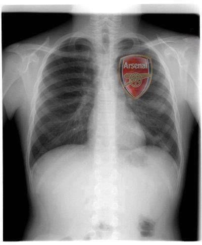 I still believe we can win this league and the Champions league. @Arsenal