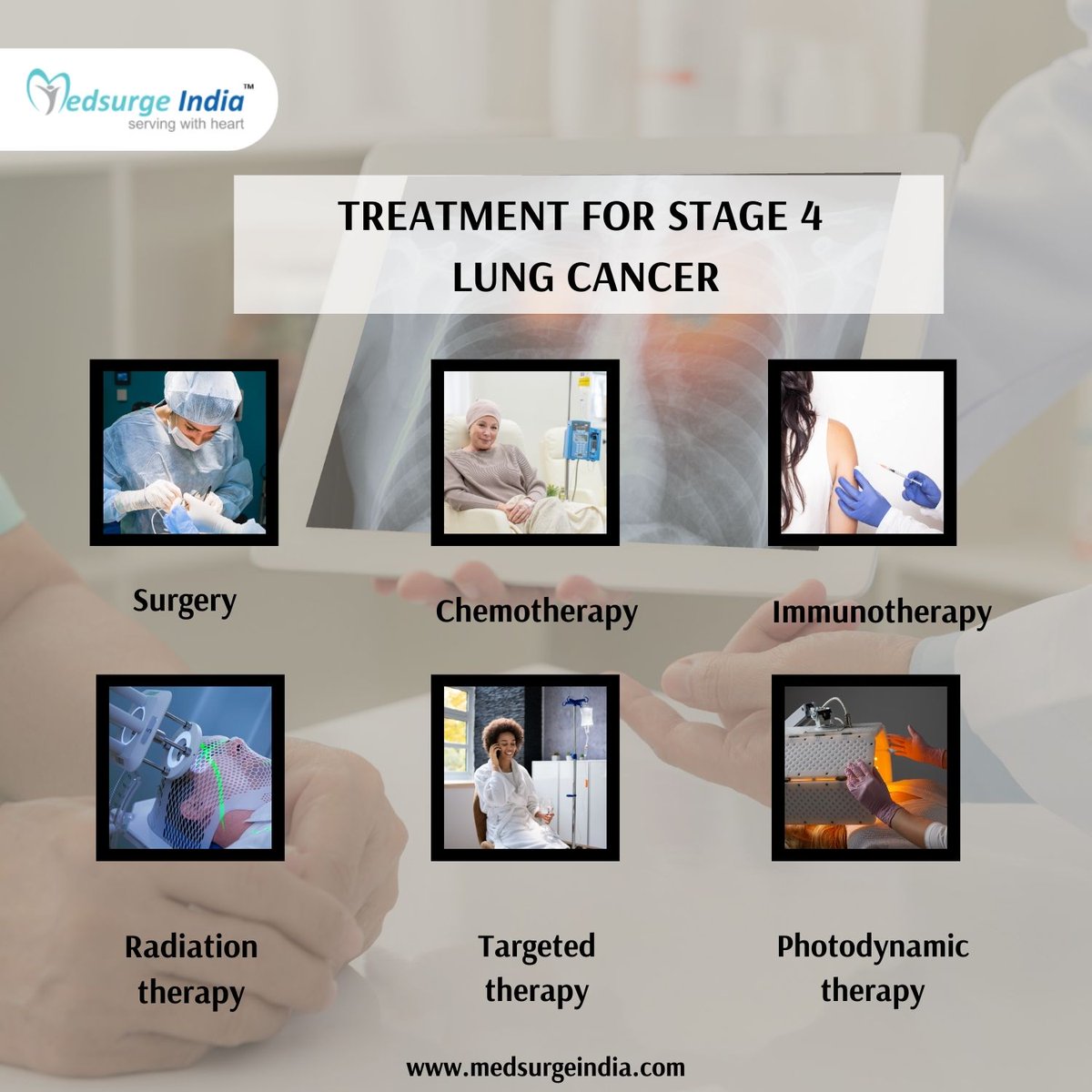 Treatment for stage 4 #lungcancer will depend on the extent of how much #cancer has spread to the body, the presence of genetic mutations in the body, and the overall #health of the patient. Click - rb.gy/0s1icw #cancertreatment #cancerprevention #cancerawareness