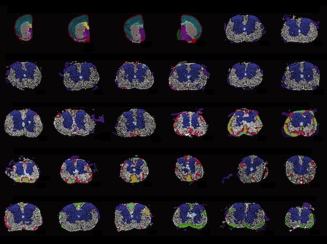 #MultipleSclerosis progression regions & timings from single cell analyses in EAE mouse model & post mortem MS patient spinal cords. Image & research by @PKukanja @chrislangseth et al @karolinskainst @MatsNilssonLab @GoCasteloBranco in @CellCellPress. On bpod.org.uk/archive/2024/4…