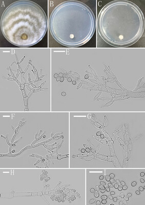 Trichoderma albidum, a new species of mould from China