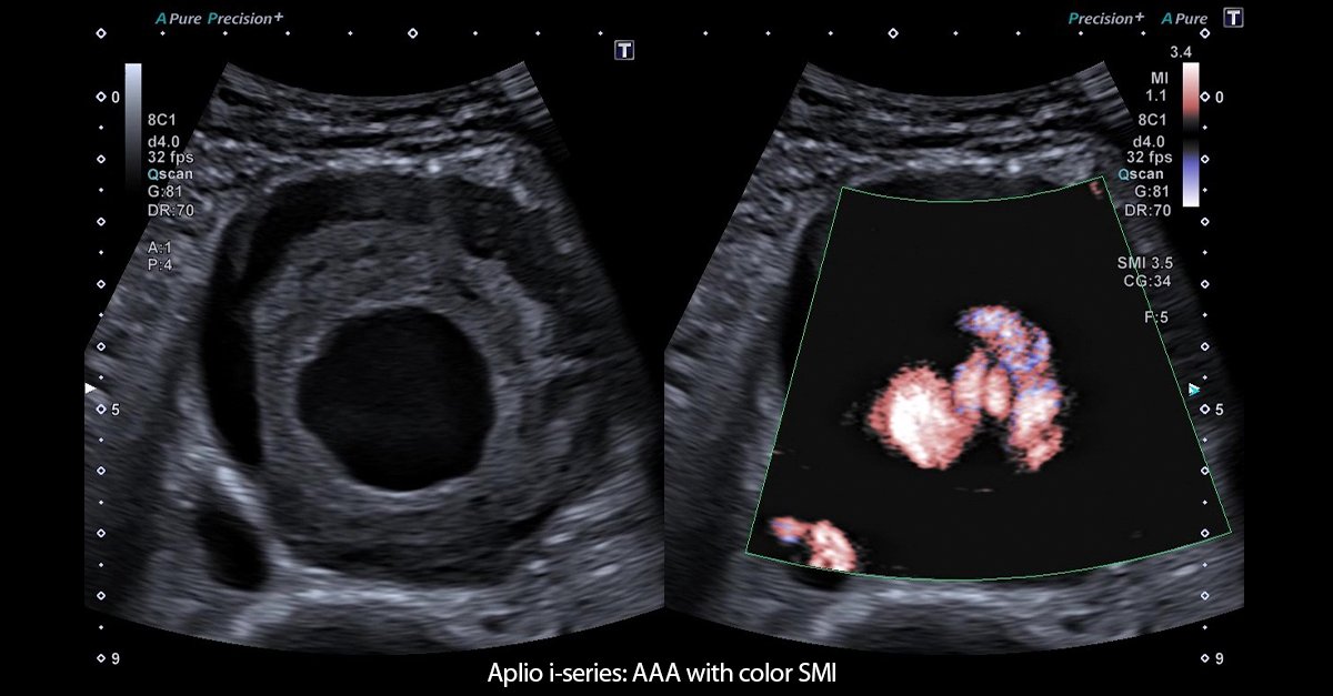 Our ongoing collaboration with Wessex Diagnostic continued today, with another two days of vascular course blending insightful lectures and hands-on workshops. Powered by the unparalleled image quality and Doppler performance of the Aplio i-series Prism Edition and a-series.